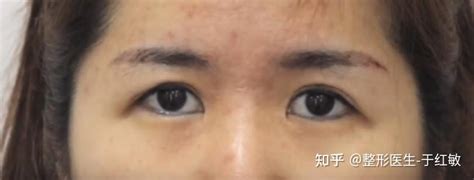 女人眼尾下垂面相|【眼尾下垂面相女】眼尾下垂面相女的命運：吉？兇？一次釐清！。